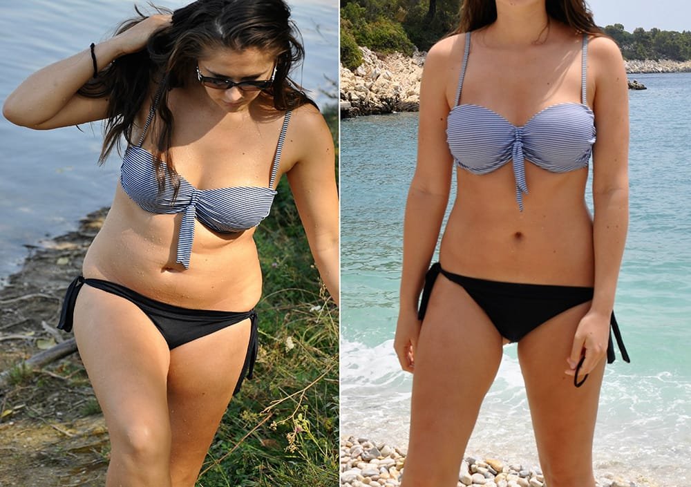 GLP-1 Weight Loss